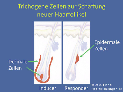 Trichogene Zellen zur Schaffung neuer Haarfollikel