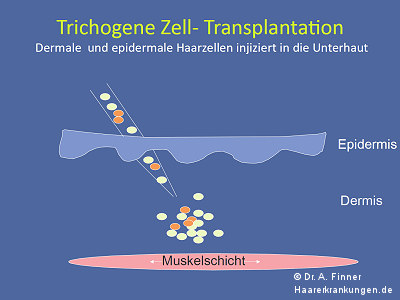 Trichogene Zell-Transplantation